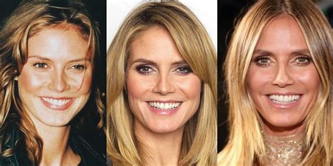 Has Heidi Klum Had Plastic Surgery? Exploring the Endless Possibilities of Beauty Transformations