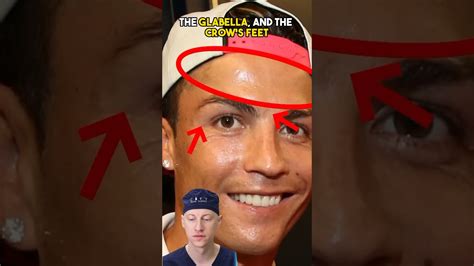 Has Ronaldo Had Plastic Surgery? Exploring the Rumors and Realities